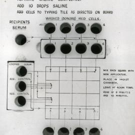Indirect Coombs test, Royal Newcastle Hospital, Newcastle, NSW