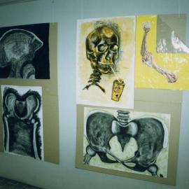 Artworks for Healthy Bones Week, Royal Newcastle Hospital, Newcastle, NSW, 9 August 1999